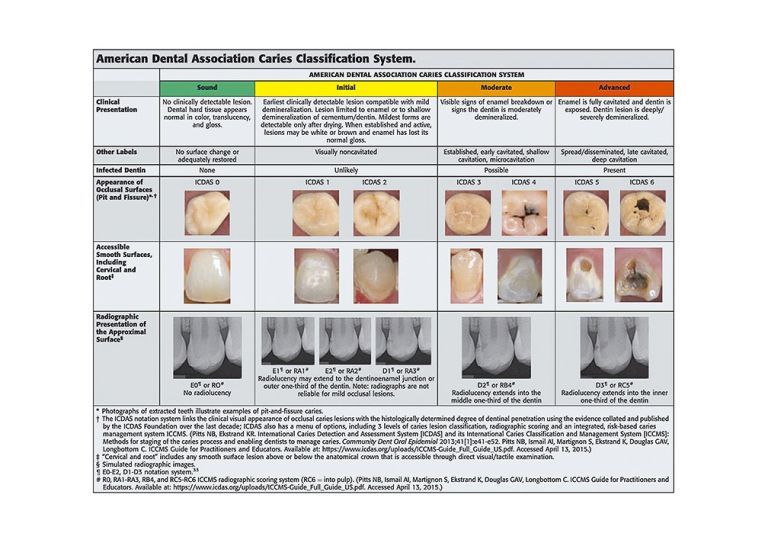 American Dental Association caries classification system.