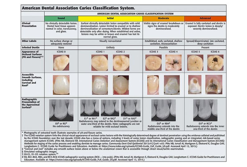 Dental Caries: An Update on Dental Trends and Therapy | University of ...